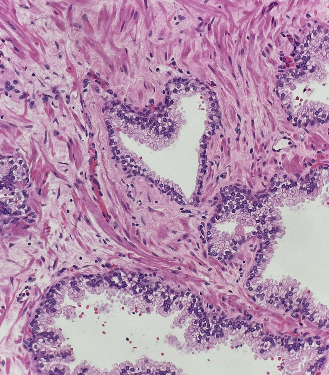 MeredithKHerman's tweet image. It’s time for a #PathQuiz 🧐
Test your knowledge on #GUPath below 💡 can you get all 10?
#PathX #histopath 

/🧵