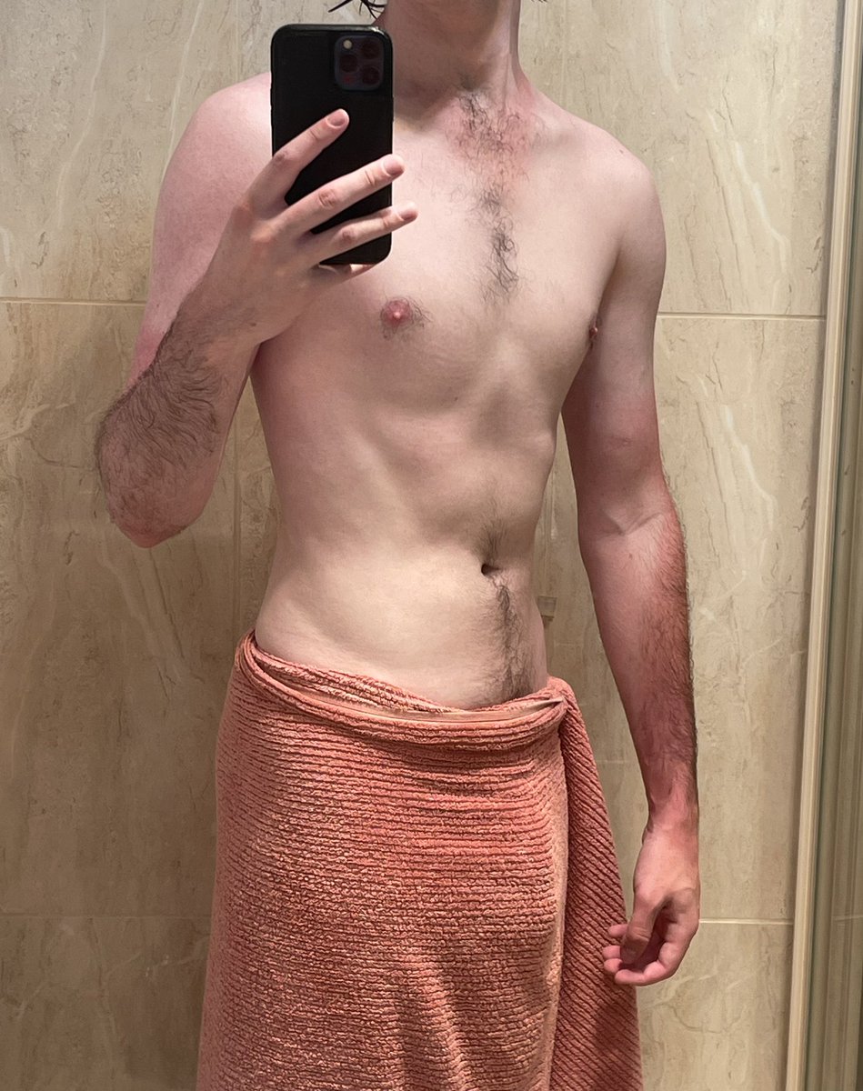 perth_twink's tweet photo. please ignore the weird sunburns xx https://t.co/ixjzWmYn3x