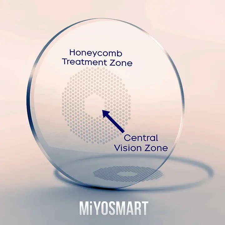 mataclinic's tweet image. Hoya MiYOSMART lenses use advanced DIMS technology to correct vision &amp;amp; slow myopia progression in kids. A safe, non-invasive way to protect young eyes and ensure a clearer future!

#MiYOSMART #MyopiaManagement #KidsEyeHealth #VisionCare #Optometry #ClearVision #HealthyEyes