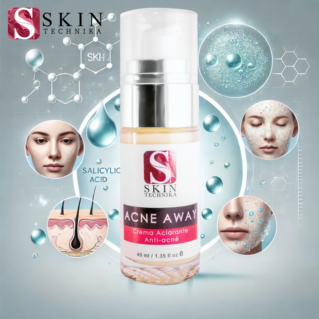 SkinTechnika's tweet photo. 💡 El ácido salicílico es tu mejor aliado contra el acné. Acne Away de Skin Technika limpia los poros y reduce la grasa sin resecar. ¡Pruébalo! 💧 #AcidoSalicilico #AcneAway #CuidadoDeLaPiel #SkinTechnika https://t.co/95v4k9EEbn