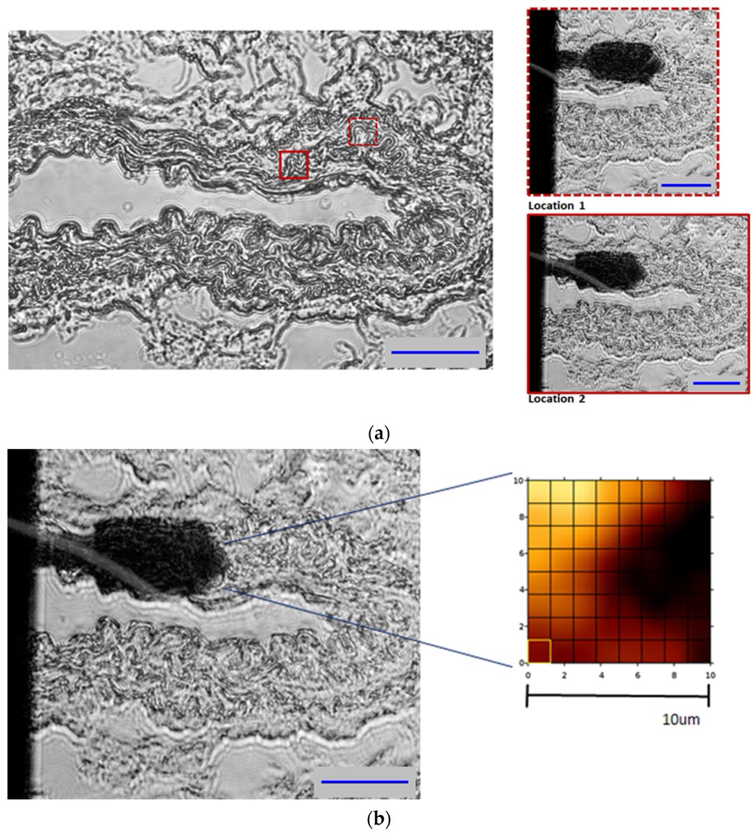Applsci's tweet image. 🔥 Read our Paper
📚 Biomechanical Characterization of Abdominal Aortic Aneurysm: The Rupture Mechanism
🔗 mdpi.com/2076-3417/14/2…
👨‍🔬 by Yingnan Zhai et al.
#ruptureprediction #atomicforcemicroscopy
@FloridaTech