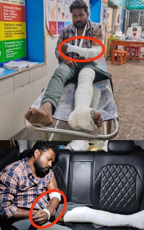 senthil64096870's tweet photo. #AnnaUniversity 
#TamilNaduPolice 
மாவு கட்டு...மயிறு கட்டு...னு
மருத்துவ ரீதியாக நிருபிச்சுட்டு...
இவனையும் இவன் கூட்டாளியும் 
நெத்தி பொட்டுலே போடற விட்டுட்டு... https://t.co/eXHrlx4kYo