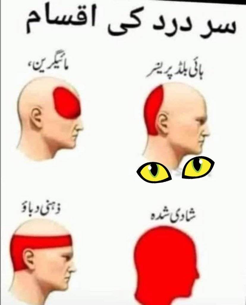 آپ کو کون سا درد ہوتا ہے۔۔
😂🤭😂😂