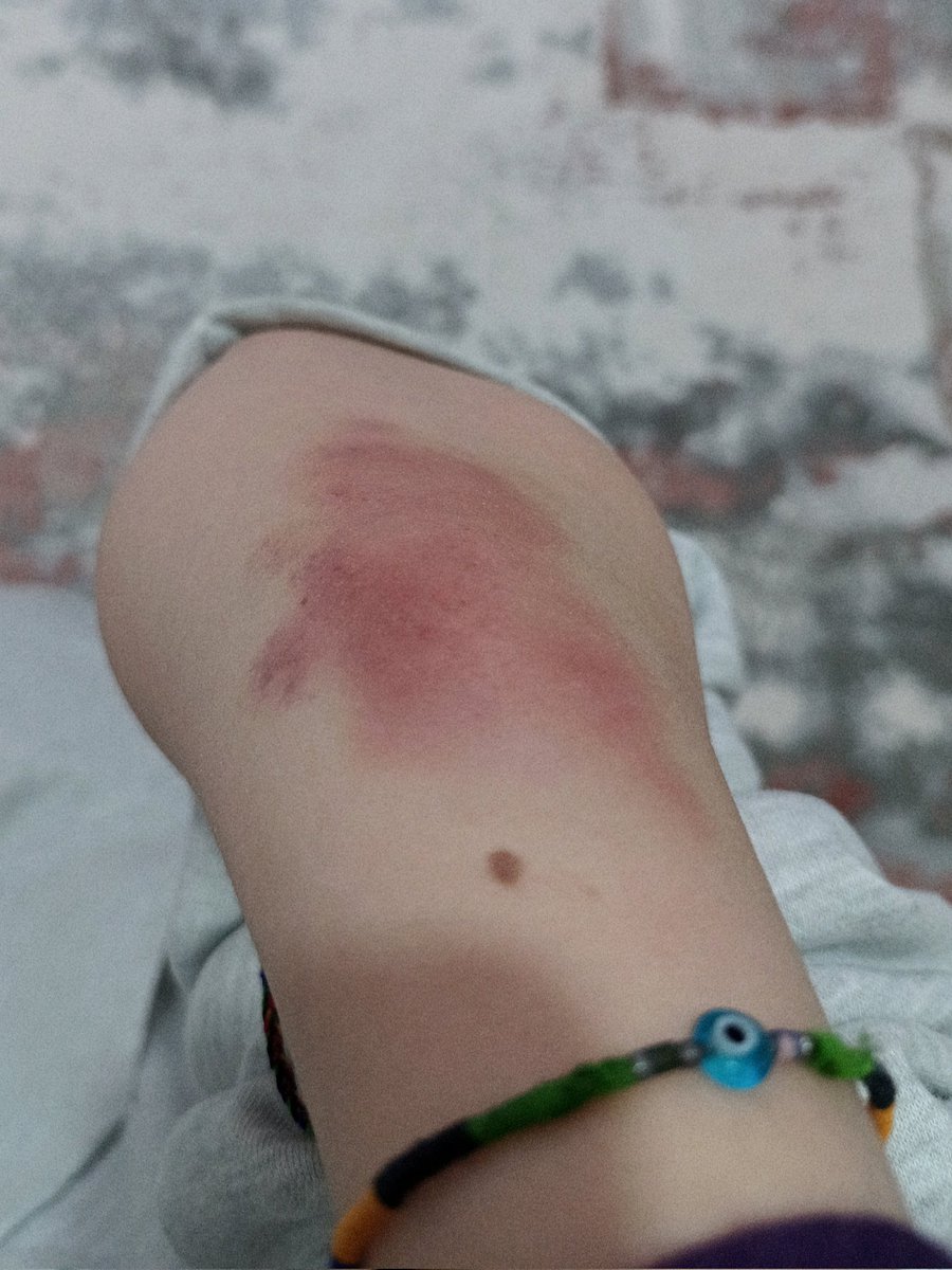 mematimaske tweet media