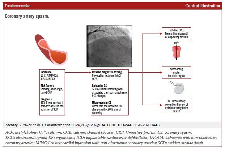 Coronary spasm: a significant cause of #MINOCA and chronic chest pain. This review examined advancements in understanding, diagnosis, and treatment. Learn more: ow.ly/1JIh50QrbFp #Cardiology