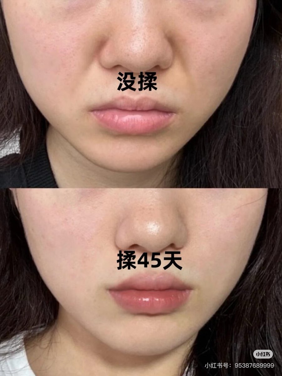 紅美女🇨🇳 tweet media