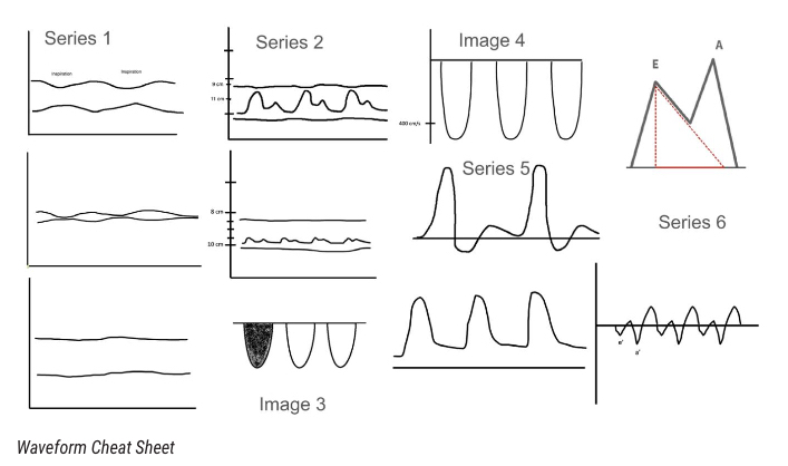 Our Director of Ultrasound, Dr. Jian, recently had an article published in SAEM Pulse covering  waveforms produced by spectral Doppler and M-mode! Congrats Dr Jian!