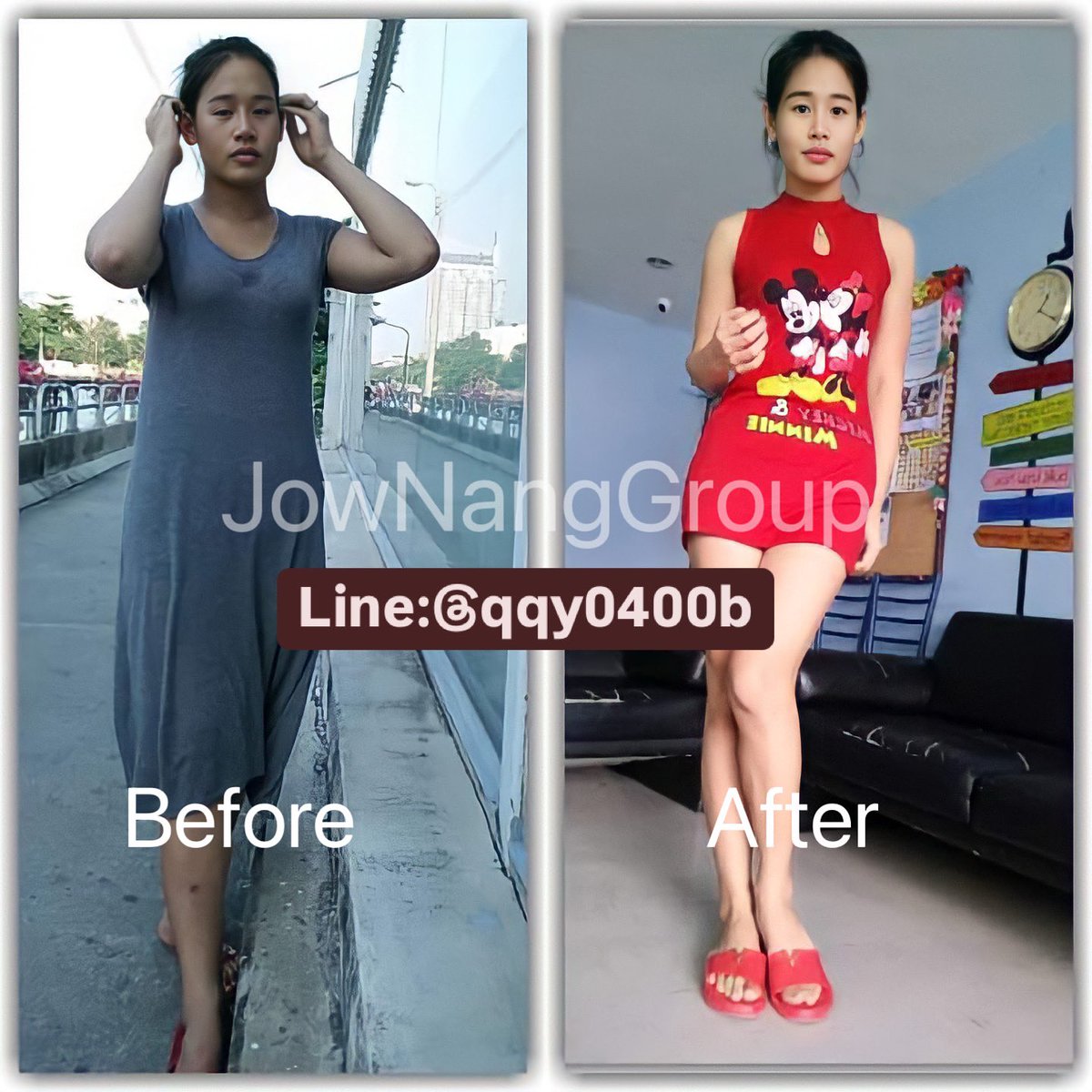 🤩 ผลลัพธ์ชัดเจน เห็นผลแน่นอน 96% ของลูกค้าทั้งชาย/หญิง ประทับใจสุดๆ เซ็ตลดน้ำหนักที่ปังที่สุด

รบกวนแอดไลน์ Line ID : @qqy0400b (มี@ด้วย) 🙏

#ยาลดความอ้วน #ยาลดน้ำหนัก #ยาลดน้ำหนักคลินิค #ยาลดความอ้วน #ยาลดความอ้วนราคาส่ง #ยาลดน้ำหนักราคาส่ง #ยาลดน้ำหนักคลินิคของแท้