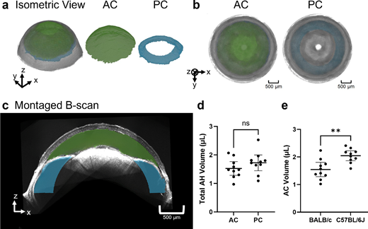 FOIL NU (@visibleoct) on Twitter photo New work using visible-light OCT #visOCT to quantify the anterior and posterior chamber volumes in vivo in mice is out <a href="/ARVOiovs/">IOVS Journal</a>.
doi.org/10.1167/iovs.6…
We show that previous studies likely overestimated the aqueous inflow rate by approximately twofold in mice.
#Ophthalmology New work using visible-light OCT #visOCT to quantify the anterior and posterior chamber volumes in vivo in mice is out <a href="/ARVOiovs/">IOVS Journal</a>.
doi.org/10.1167/iovs.6…
We show that previous studies likely overestimated the aqueous inflow rate by approximately twofold in mice.
#Ophthalmology