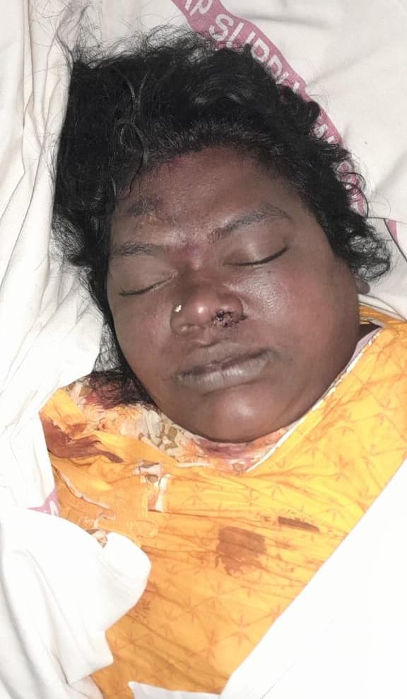 YSJaganTimes's tweet image. తిరుపతి తొక్కిసలాటలో గాయపడి రుయా హాస్పాటల్ లో చికిత్స పొద్దుతూ మరణించిన వారు😢

శాంతి (40) - వైజాగ్ 
రజనీ (47) - వైజాగ్ 
రాజేశ్వరి మల్లికా (49) - సెలం
నాయుడు బాబు (51) - నర్సీపట్నం 

#SaveTirumalaFromTDP 
#APisNotinSafeHands 
#CBNFailedCM