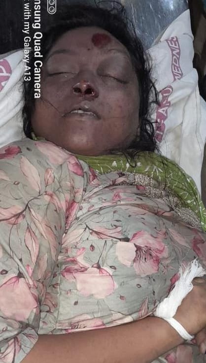 YSJaganTimes's tweet image. తిరుపతి తొక్కిసలాటలో గాయపడి రుయా హాస్పాటల్ లో చికిత్స పొద్దుతూ మరణించిన వారు😢

శాంతి (40) - వైజాగ్ 
రజనీ (47) - వైజాగ్ 
రాజేశ్వరి మల్లికా (49) - సెలం
నాయుడు బాబు (51) - నర్సీపట్నం 

#SaveTirumalaFromTDP 
#APisNotinSafeHands 
#CBNFailedCM