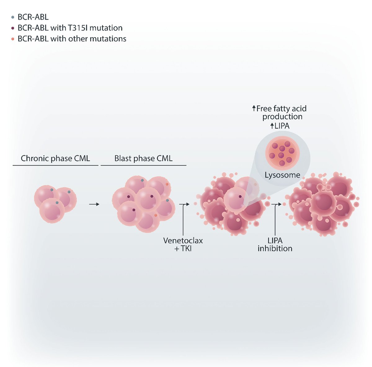 The new approach for eradicating leukemic stem cells in blast phase chronic myeloid leukemiainvolves the combination of venetoclax and tyrosine kinase inhibitors. Read the new study by Minhajuddin and colleagues.
haematologica.org/article/view/h…