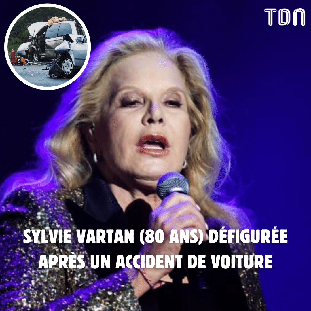 Sylvie Vartan (80 ans) défigurée après un accident de voiture ⬇️ letribunaldunet.fr/people/sylvie-…
