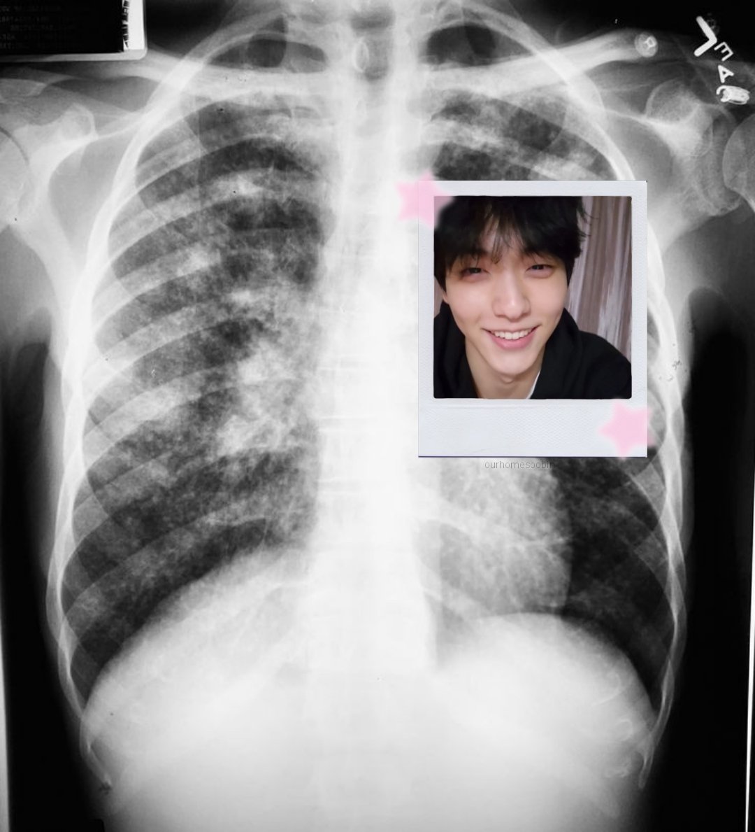 숩 (@ourhomesoobin) on Twitter photo 