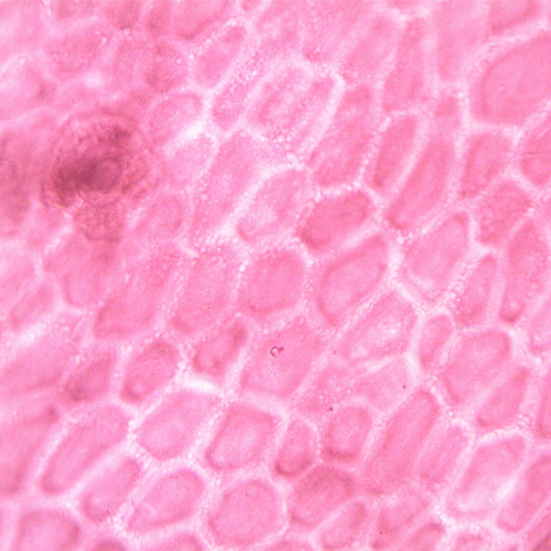 Innovative therapies that target cell-surface protein #HER2 have shown promise for treating #SalivaryGlandCancer

salivaryglandcancer.uk/salivary-gland…

#SGCAwareness  #Cure4SGC #SalivaryGlandCancerUK #SalivaryGlandCancerUpdates #SalivaryDuctCarcinoma #AdenocarcinomaNOS