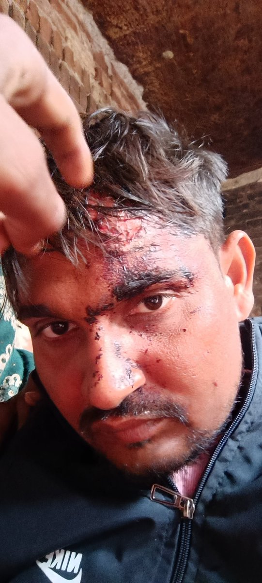 एक ही रात में क्या से क्या हो गया,,,,