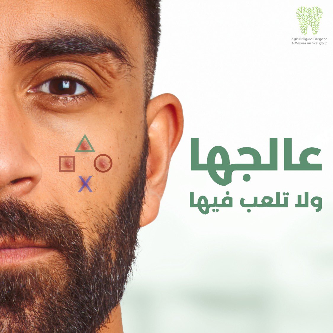 توقف عن العبث، وابدأ العلاج! عالج حب الشباب بعناية، لأن بشرتك تستحق الأفضل!

Stop the habit; start the healing, take care of your acne; your skin deserves more than just a temporary solution.

#AlMeswak #SkinCare #Botox #Filler #Lifting 
 #المسواك#عناية_بالبشرة #صحة_البشرة