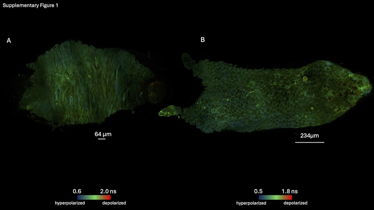 Dr. Stefania Kapsetaki (@steffikapsetaki) on Twitter photo Want to learn about the bioelectrics of immortality and mortality in cold-sensitive Hydra oligactis? Check out our preprint with <a href="/drmichaellevin/">Michael Levin</a> <a href="/TuftsUniversity/">Tufts University</a> <a href="/OSFramework/">Center for Open Science</a> osf.io/preprints/osf/… Want to learn about the bioelectrics of immortality and mortality in cold-sensitive Hydra oligactis? Check out our preprint with <a href="/drmichaellevin/">Michael Levin</a> <a href="/TuftsUniversity/">Tufts University</a> <a href="/OSFramework/">Center for Open Science</a> osf.io/preprints/osf/…