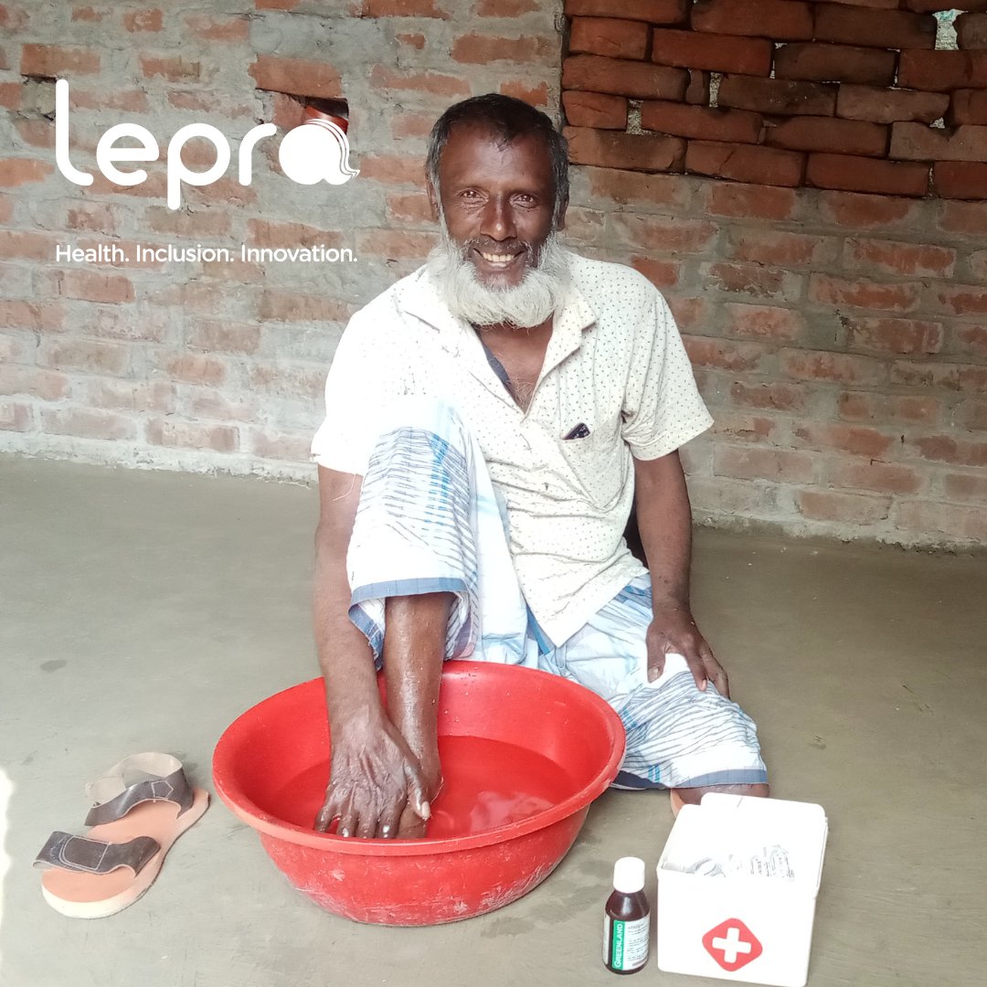In 2012, Astan noticed patches appearing on his body. He spent a large amount of money on traditional treatments but these proved futile. The patches didn’t itch or hurt but he experienced numbness &amp; lost strength in his arms &amp; legs.  Read Astan's story: lepra.org.uk/real-life-stor…