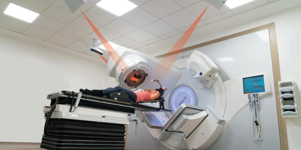 Nearly 2 years to the day of treating our 1st patient with SGRT we have gone live treating our 5th treatment site, Prostate radiotherapy with SGRT. It’s great to be able to keep expanding the benefits of Surface Guided Radiotherapy to more patients.