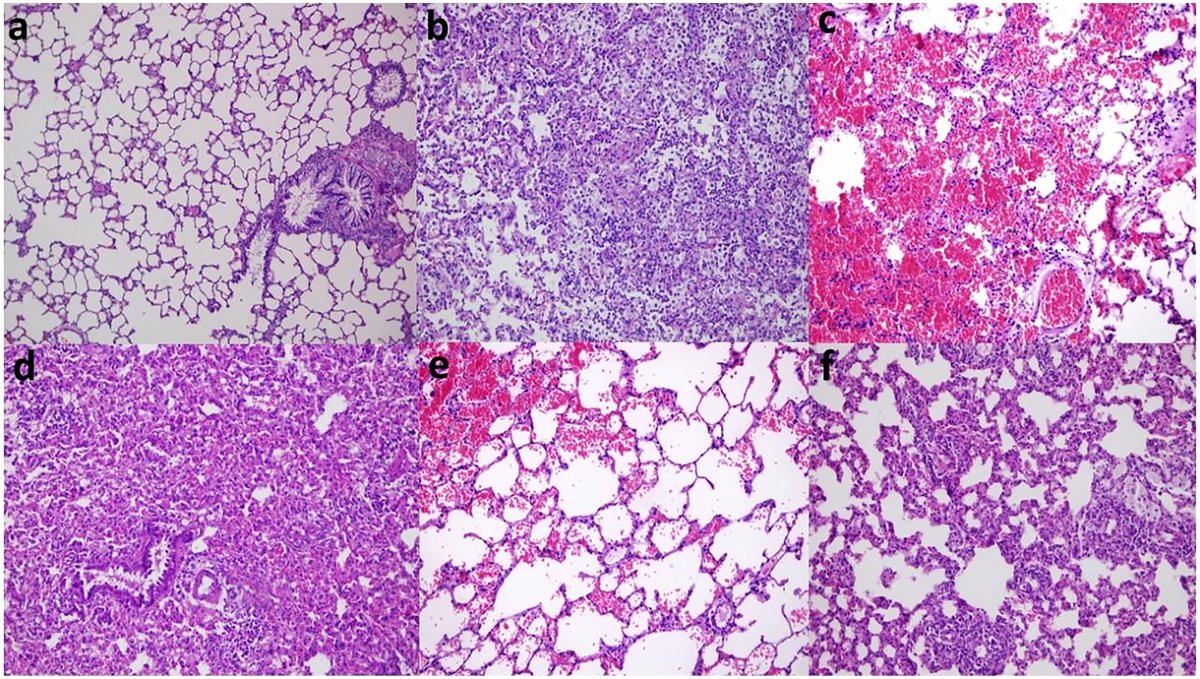 Melatonin as a radioprotective agent against flattening filter and flattening filter-free beam in radiotherapy-induced lung tissue damage bit.ly/3PoKSvb 

#radiotherapy #radioprotection #research #ijrb