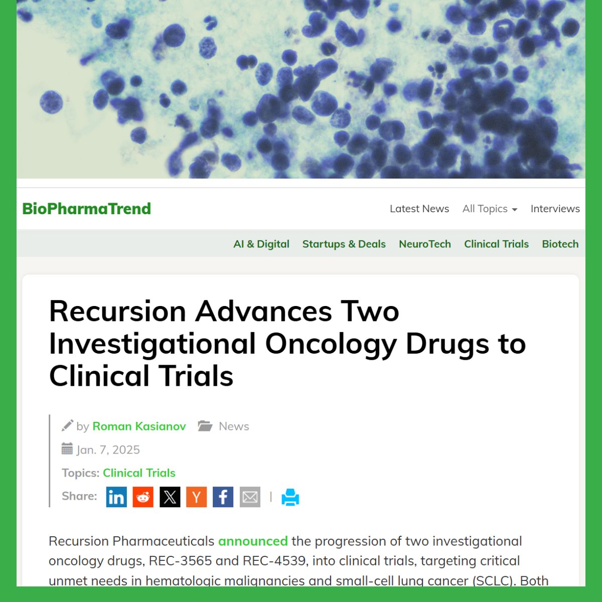 Recursion (@recursionpharma) on Twitter photo A new story from <a href="/BiopharmaTrend/">BiopharmaTrend</a> looks at our two investigational oncology drugs progressing to clinical trials – REC-3565 and REC-4539 – which target critical unmet needs in hematologic malignancies and small-cell lung cancer (SCLC).
They write: “Both programs exemplify the A new story from <a href="/BiopharmaTrend/">BiopharmaTrend</a> looks at our two investigational oncology drugs progressing to clinical trials – REC-3565 and REC-4539 – which target critical unmet needs in hematologic malignancies and small-cell lung cancer (SCLC).
They write: “Both programs exemplify the