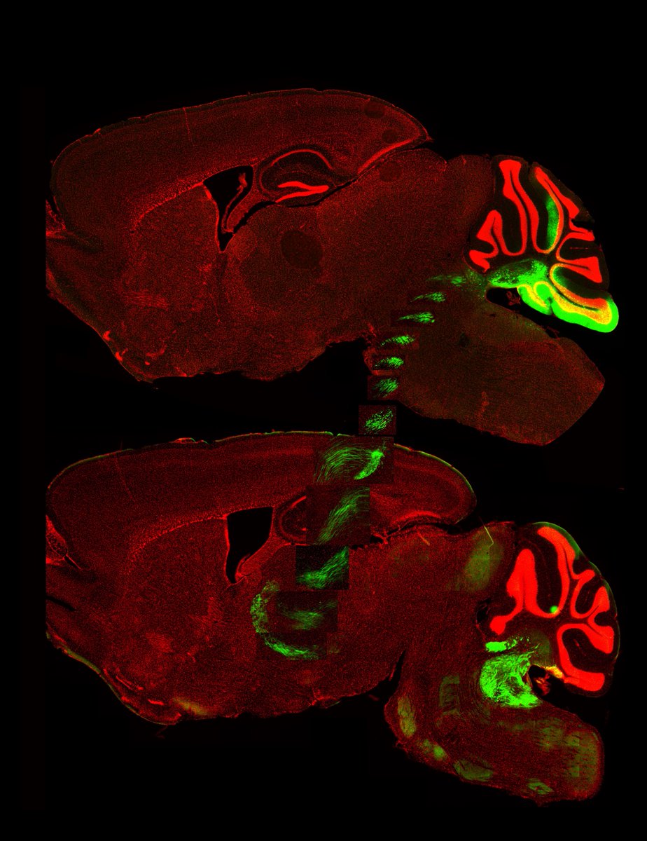 SfNJournals's tweet photo. #SnapshotsinNeuroscience | Featured on the #eNeuro blog, sagittal mouse brain sections showing cerebellar nuclei sending afferents to the ventral posterolateral nucleus of the thalamus from Witteveen and Balmer.
Image credit: Isabelle Witteveen.
https://t.co/P2uJGYbRGE https://t.co/vp0phEpWmi