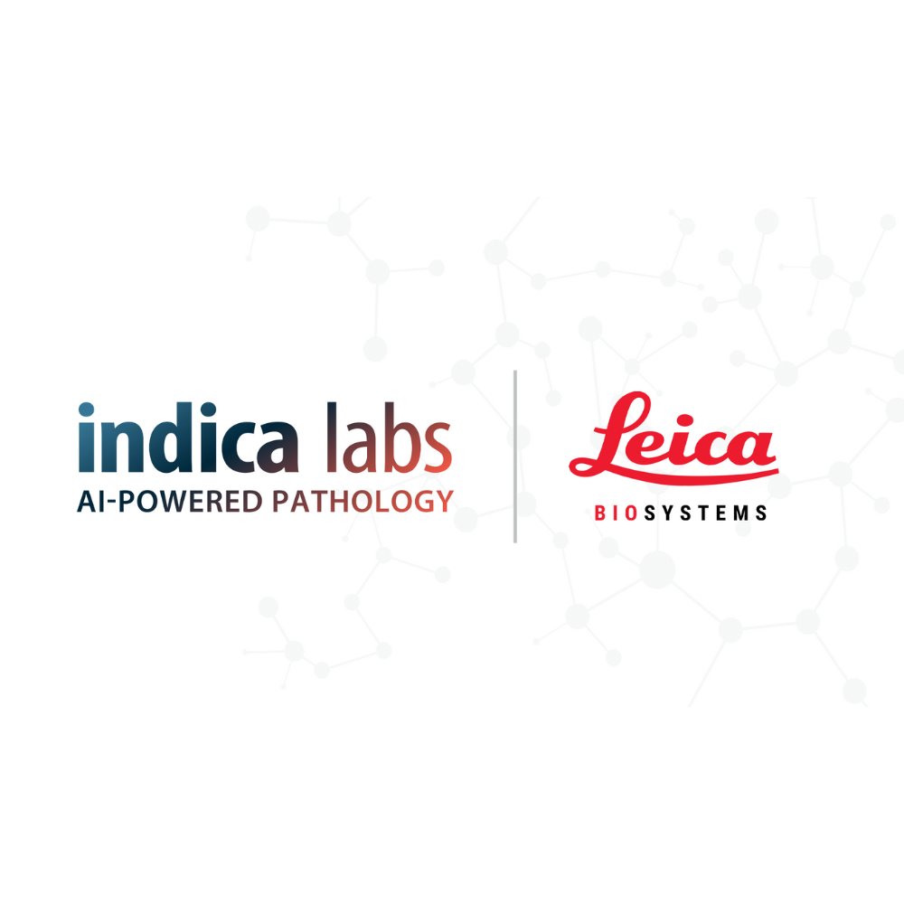 James Krallen (@jameskrallen) on Twitter photo 🚨 Big news in digital pathology! Leica Biosystems <a href="/LeicaBio/">Leica Biosystems</a> and <a href="/Indica_Labs/">Indica Labs</a> team up to launch an AI-powered diagnostic platform, combining cutting-edge scanners & software for faster, more effective treatment.
Read more: pathologynews.com/industry-news/…
#AI #health #cancer #treatment 🚨 Big news in digital pathology! Leica Biosystems <a href="/LeicaBio/">Leica Biosystems</a> and <a href="/Indica_Labs/">Indica Labs</a> team up to launch an AI-powered diagnostic platform, combining cutting-edge scanners & software for faster, more effective treatment.
Read more: pathologynews.com/industry-news/…
#AI #health #cancer #treatment