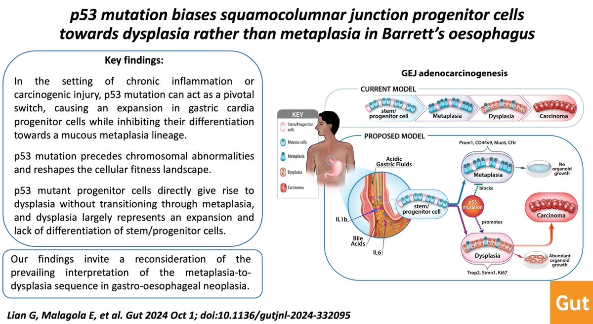 Gut_BMJ's tweet photo. #GUTAbstract by @yiyanqiannian1 et al on the paper entitled

"p53 mutation biases squamocolumnar junction progenitor cells towards dysplasia rather than metaplasia in Barrett’s oesophagus" via

https://t.co/9YFdPxZ0sA

Paper: https://t.co/xwLCkBNOpN

@LeahZam #Barretts #p53 https://t.co/tJ4sRXVFNr
