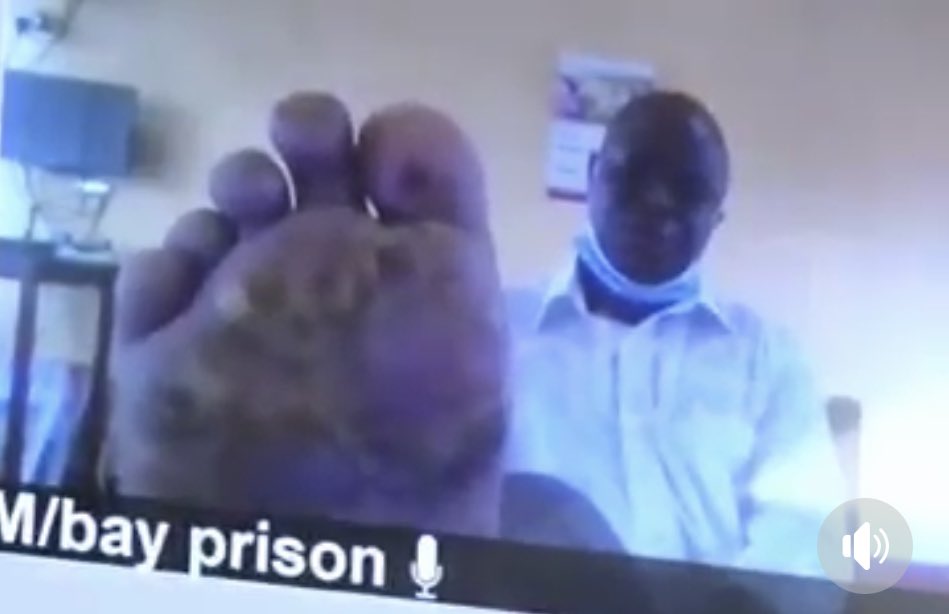 Hon. Ssegirinya, while appearing before Buganda Road Court via video conferencing in October 2021 (and on another occasion), displays his rotting feet that he attributed to torture. He was requesting to be released for treatment. His mother loudly wailed in court, pleading for
