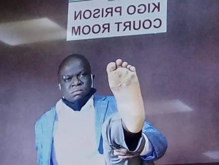SpireJim's tweet photo. Hon. Ssegirinya, while appearing before Buganda Road Court via video conferencing in October 2021 (and on another occasion), displays his rotting feet that he attributed to torture. He was requesting to be released for treatment. His mother loudly wailed in court, pleading for her son. If the consciences of those judges are still working, they must be hearing the loud cry of that woman playing back in their heads now as they follow news of his miserable death while seated with their own beloved children. 

Dear Judiciary, Police, Prisons, and ABOVE, you may forget these things, but your victims and their loved ones never forget.