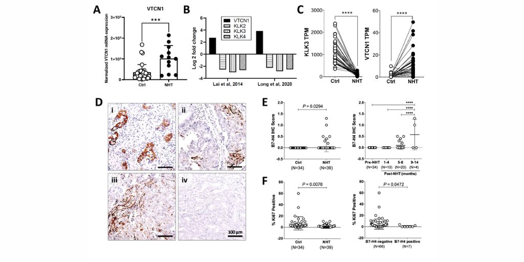 Molecular Cancer Research (@mcr_aacr) on Twitter photo Exploring B7-H4ās role in #ProstateCancer dormancy post-androgen deprivation therapy: extracellular matrix interactions and therapeutic opportunities bit.ly/4fMvYd7
<a href="/HtooZOo/">Htoo Zarni Oo</a> <a href="/madsdaug1/">Daugaard Laboratory</a> <a href="/yuzhuo_wang/">yuzhuo wang</a> <a href="/BCCancer/">BC Cancer</a> <a href="/VanProstateCtr/">Vancouver Prostate Centre</a> <a href="/UBC/">University of British Columbia</a> <a href="/genome_me/">GenomeMe Labs Inc.</a> Exploring B7-H4ās role in #ProstateCancer dormancy post-androgen deprivation therapy: extracellular matrix interactions and therapeutic opportunities bit.ly/4fMvYd7
<a href="/HtooZOo/">Htoo Zarni Oo</a> <a href="/madsdaug1/">Daugaard Laboratory</a> <a href="/yuzhuo_wang/">yuzhuo wang</a> <a href="/BCCancer/">BC Cancer</a> <a href="/VanProstateCtr/">Vancouver Prostate Centre</a> <a href="/UBC/">University of British Columbia</a> <a href="/genome_me/">GenomeMe Labs Inc.</a>