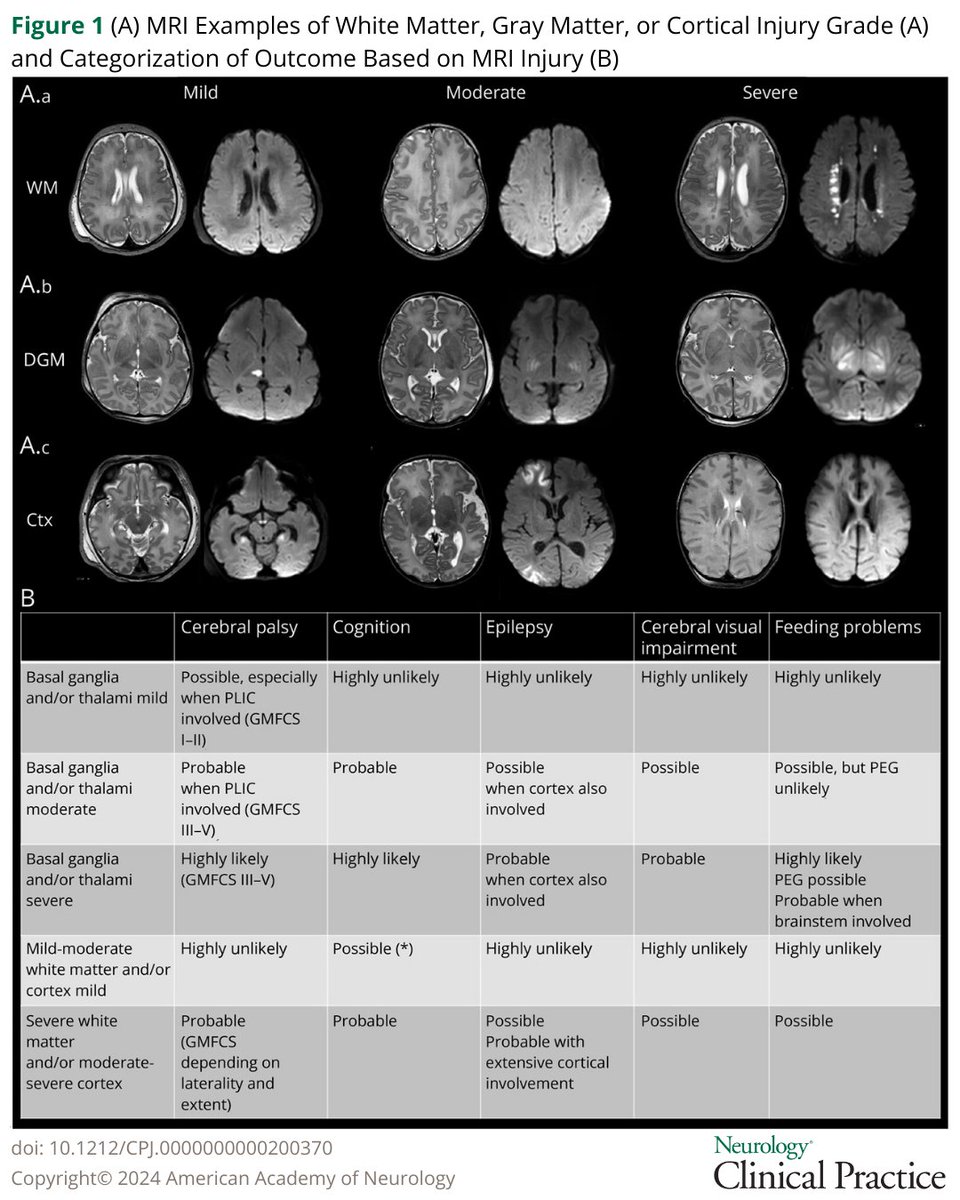 This restrospective study investigated whether post-rewarming brain MRI enables individualized domain-specific prediction of neurodevelopmental outcomes at 2 yrs of age in infants treated with hypothermia for hypoxic-ischemic brain injury: bit.ly/4e3NjgK

#NeuroTwitter