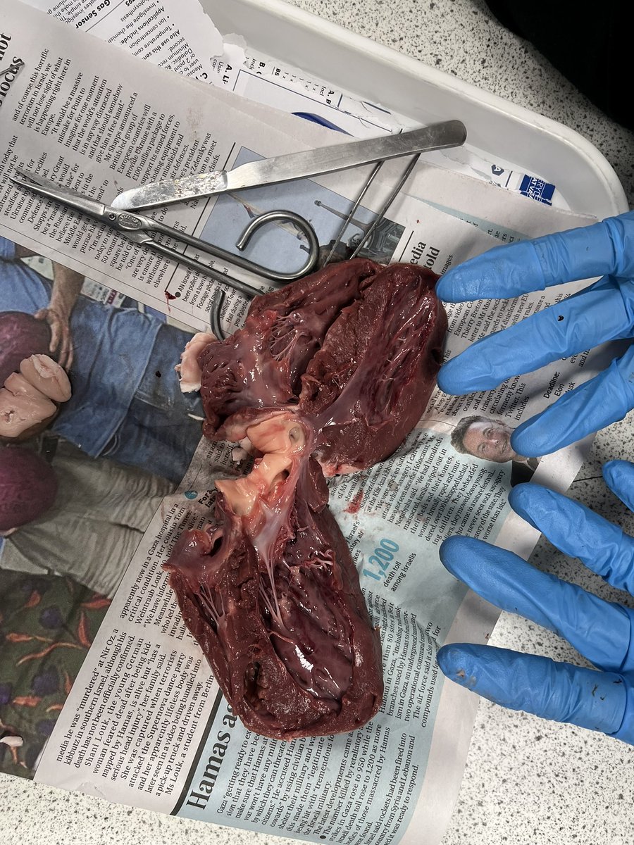 The Adeyfield Academy PE department (@adeyfieldpe) on Twitter photo Mr Mellor’s Yr10 GCSE PE getting hands on when studying cardiovascular structure with a heart dissection. Thank you to Miss Paterson for her expertise. Mr Mellor’s Yr10 GCSE PE getting hands on when studying cardiovascular structure with a heart dissection. Thank you to Miss Paterson for her expertise.