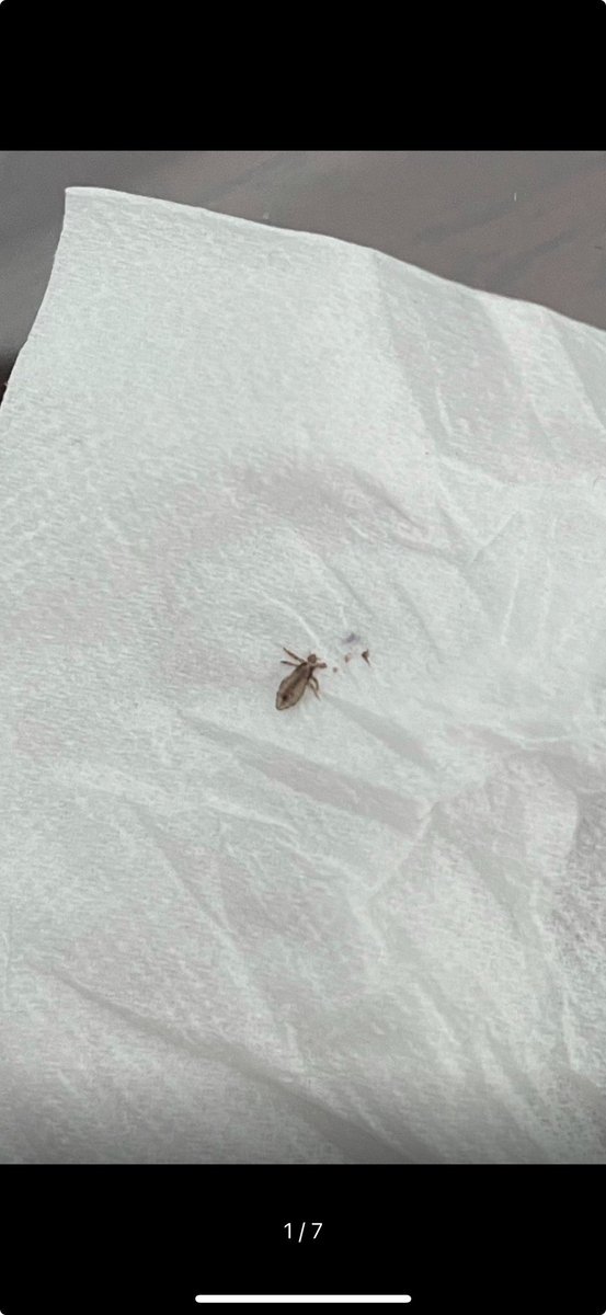 Lisa Wolfe (@wolfelisa) on Twitter photo <a href="/united/">United Airlines</a> Today, I sat in First Class in seat 2A on Flight 2100 from EWR to ORD and found lice all over my backpack, purse, and clothes. Not even first class lice! Not recommended! <a href="/united/">United Airlines</a> Today, I sat in First Class in seat 2A on Flight 2100 from EWR to ORD and found lice all over my backpack, purse, and clothes. Not even first class lice! Not recommended!