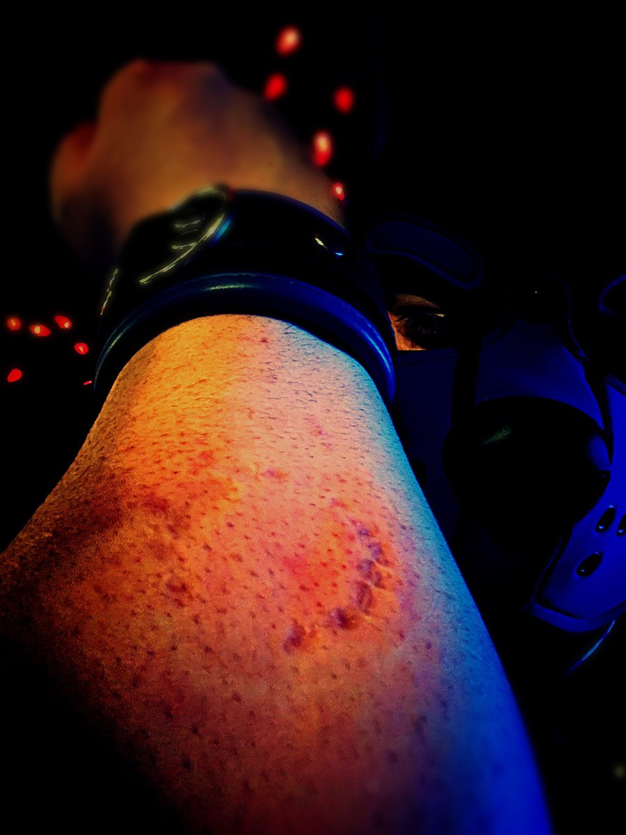 Pup Jazper blue (@jazperblueii) on Twitter photo When your Dom get feral and decides to mark his pup…
<a href="/pup_zoricus/">thatRUBBERtoi aka Zori 🔜LFW🔜SA</a> #bite #pupplay When your Dom get feral and decides to mark his pup…
<a href="/pup_zoricus/">thatRUBBERtoi aka Zori 🔜LFW🔜SA</a> #bite #pupplay