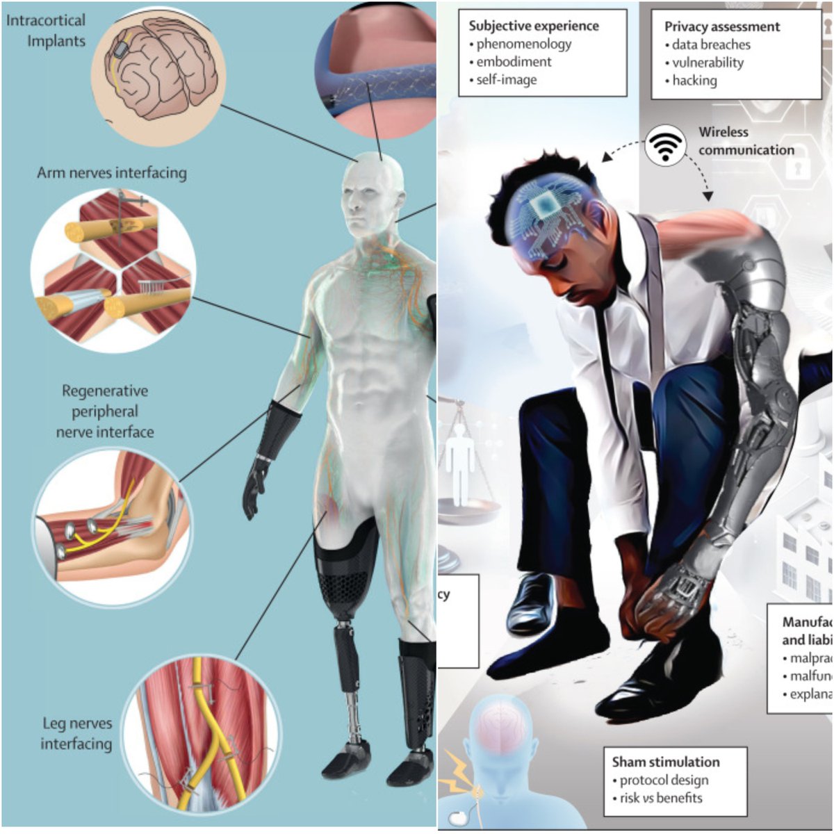 Marcello Ienca (@marcelloienca) on Twitter photo 🚨New Paper Out in <a href="/LancetDigitalH/">The Lancet Digital Health</a>🚨 "Clinical trials for implantable neural prostheses: understanding the ethical and technical requirements" Collaborative work with brilliant co-authors <a href="/giacomo_valle/">Giacomo Valle</a> and <a href="/SRaspopovic/">Stanisa Raspopovic</a>.
🔎 Why this matters: Neuroprosthetics research is rapidly 🚨New Paper Out in <a href="/LancetDigitalH/">The Lancet Digital Health</a>🚨 "Clinical trials for implantable neural prostheses: understanding the ethical and technical requirements" Collaborative work with brilliant co-authors <a href="/giacomo_valle/">Giacomo Valle</a> and <a href="/SRaspopovic/">Stanisa Raspopovic</a>.
🔎 Why this matters: Neuroprosthetics research is rapidly