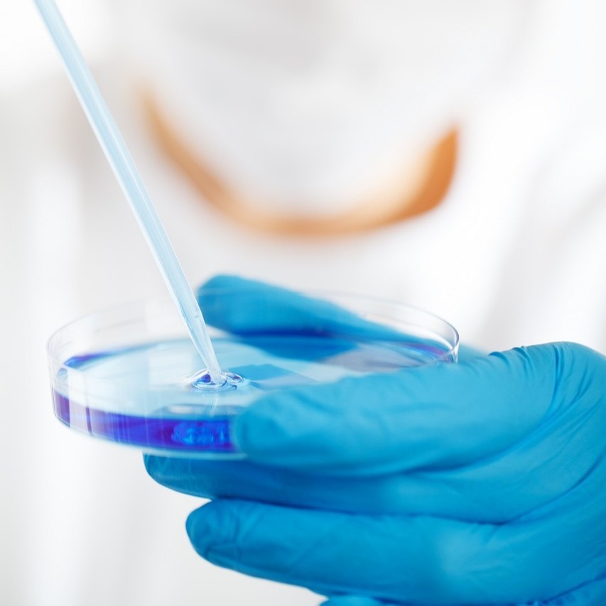Extracellular Matrix News (@extracellmatrix) on Twitter photo ๐ In this <a href="/SciReports/">Scientific Reports</a> study, <a href="/Nordic_Bio/">Nordic Bioscience</a> scientists highlight fibro-inflammatory profiles associated with TNF-ฮฑ or IL-13 stimulation.
They support the use of tofacitinib as an anti-fibrogenic treatment in chronic inflammatory conditions. ๐ฅ
go.nature.com/427bVmc ๐ In this <a href="/SciReports/">Scientific Reports</a> study, <a href="/Nordic_Bio/">Nordic Bioscience</a> scientists highlight fibro-inflammatory profiles associated with TNF-ฮฑ or IL-13 stimulation.
They support the use of tofacitinib as an anti-fibrogenic treatment in chronic inflammatory conditions. ๐ฅ
go.nature.com/427bVmc