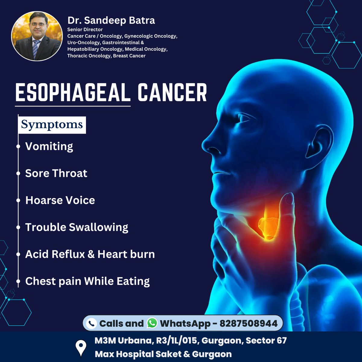 ESOPHAGEAL CANCER
Symptoms
Vomiting
Sore Throat
Hoarse Voice
Trouble Swallowing
Acid Reflux &amp; Heart burn
📷Dr. Sandeep Batra
Consultant:- Cancer Expert
Contact us at 📷8287508944
Visit us 📷M3M Urbana, R3/1L/015, Gurgaon, Sector 67 Max Hospital Saket &amp; Gurgaon
#esophagealcancer
