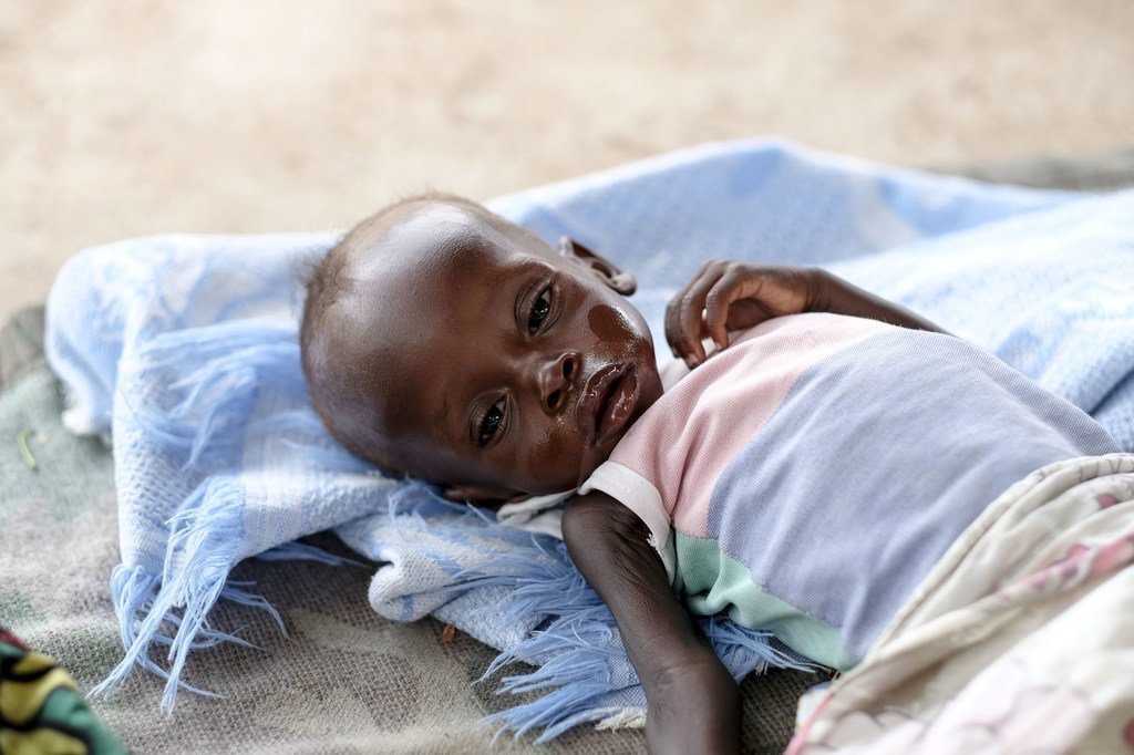 🇸🇩 FLASH - 3,2 millions d’enfants de moins de 5 ans souffrent de malnutrition aigüe au Soudan. (Unicef)