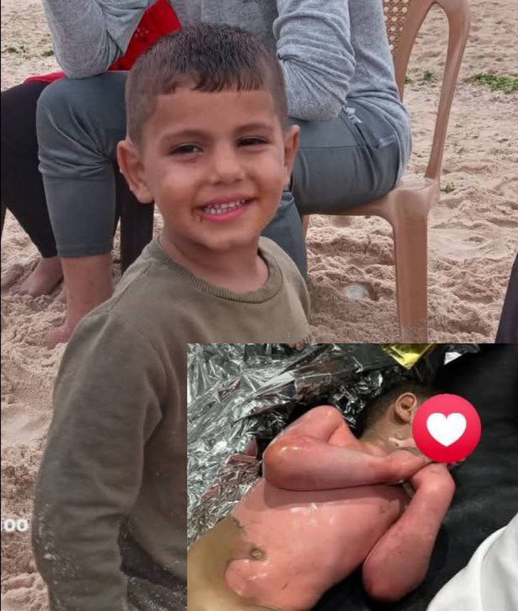 6 yaşındaki çocuk Abdurrahman Nabhan, savaşın ve açlığın pençesindeki Gazze'de bir yemek dağıtım noktasında kaynar tencereye düşerek hayatını kaybetti.