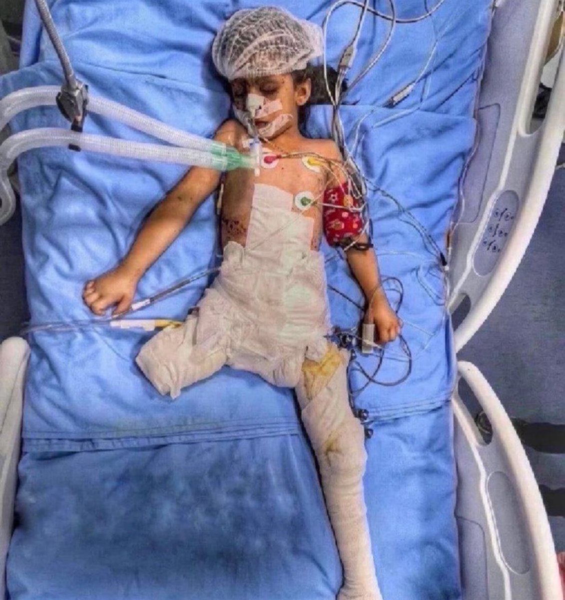 Dr. Yousef 🇵🇸 tweet media