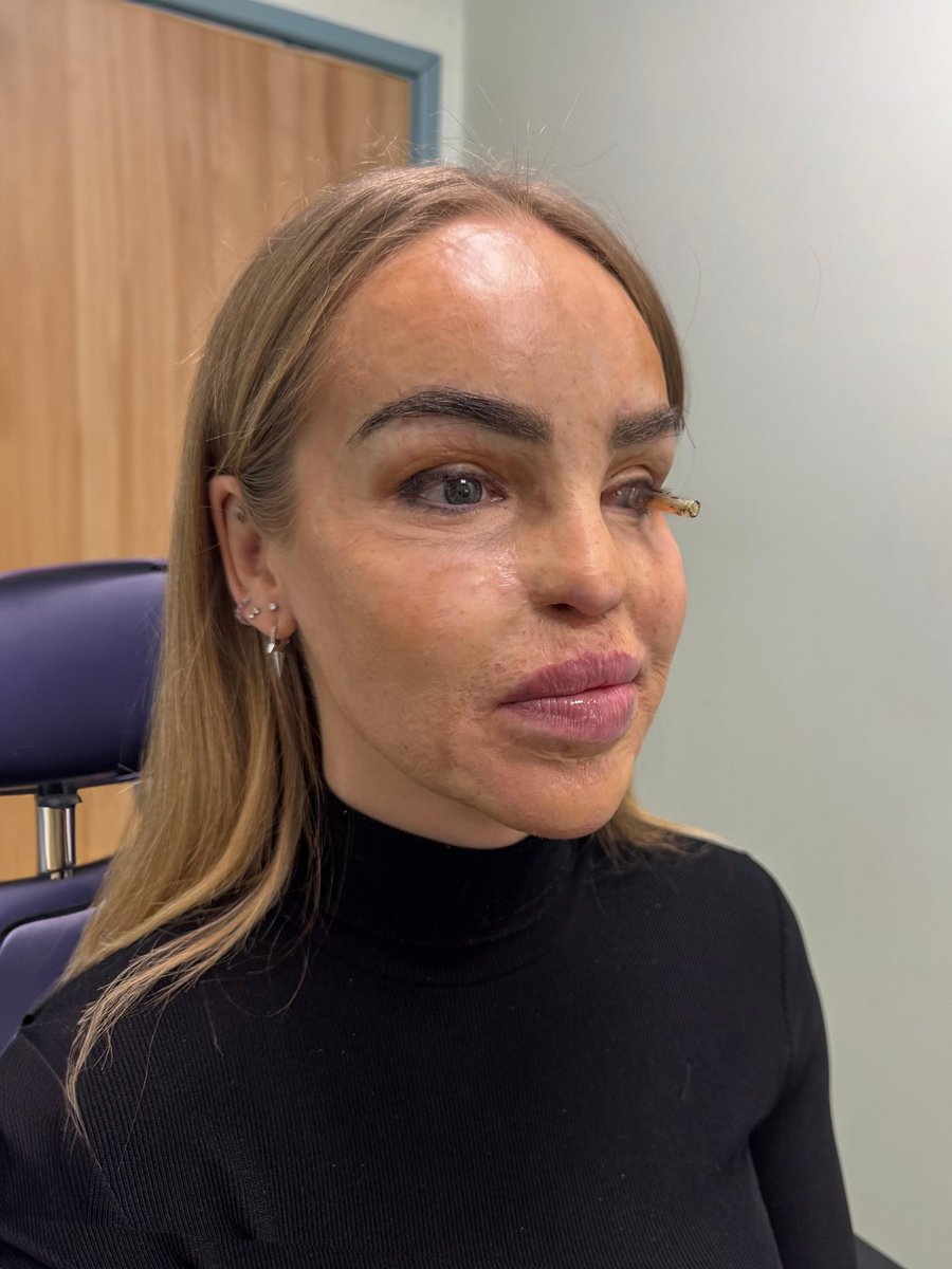 Katie Piper OBE tweet media