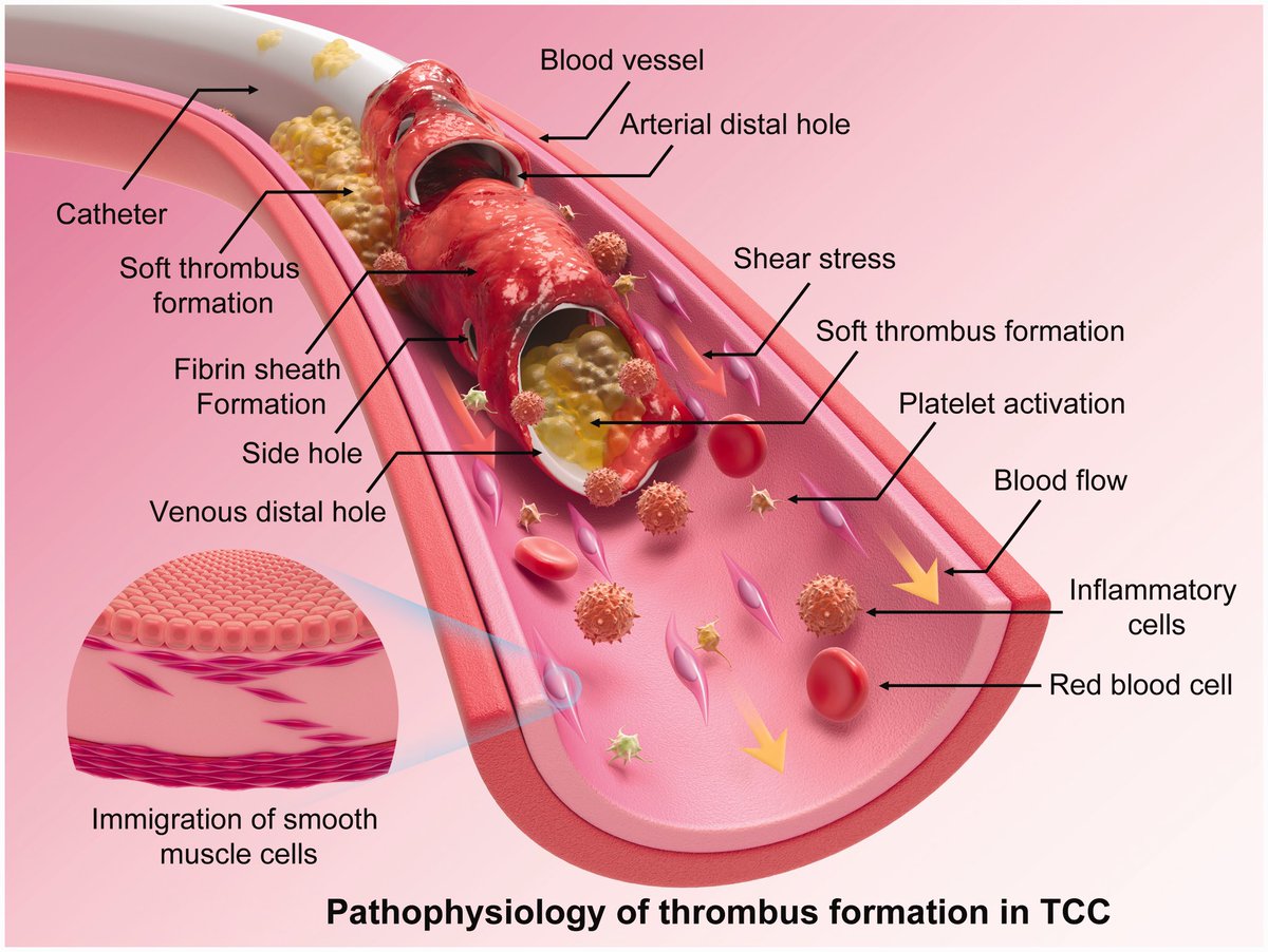 NephroPOCUS tweet media