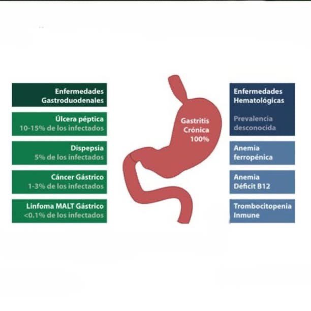 hcedron's tweet photo. El H. pylori es la infección bacteriana más frecuente. Los invitamos a revisar el artículo de revisión del Latin American Gastric Cancer, HP and Microbiota Study Group que nos presenta una Actualización sobre el diagnóstico y tratamiento de HP.
Link: https://t.co/a8LB9RN3bi https://t.co/6IyyNlQwmS