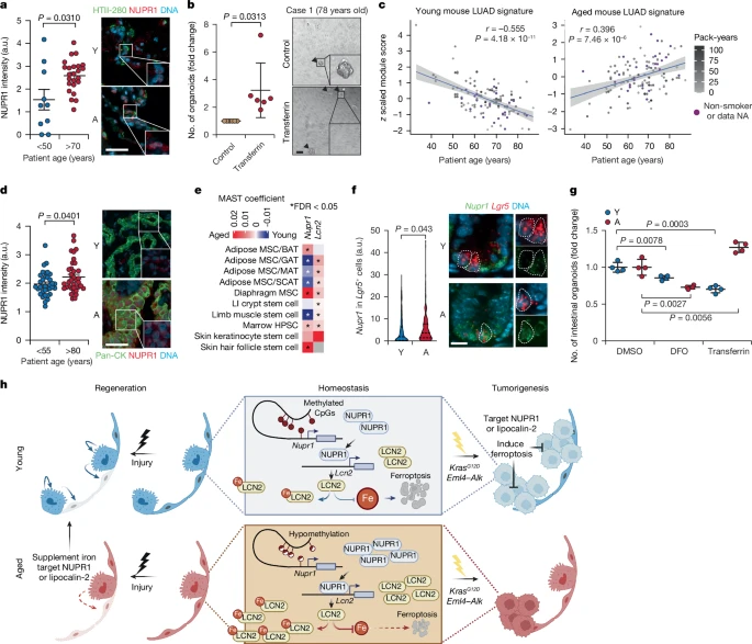 MSKLibrary's tweet photo. Featured today by @MSKLibrary: Ageing limits stemness and tumorigenesis by reprogramming iron homeostasis
#AgingResearch #IronHomeostasis #CellularAging
#CancerResearch #TumorBiology #HealthAndAging
@Xueqian_Zhuang @ferrenabio @davhum @JooHyeonLeeLab @RichardKoche @PekkaKatajisto @YadiraSotoFeli1 @TuomasTammela
https://t.co/JvzJCFljoc