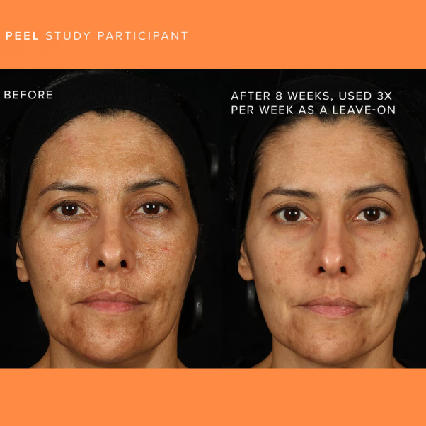 RodanFieldsHQ's tweet photo. Our latest blog post dives into the best ways to tackle both acne and dark spots, with top skincare picks designed to clear and brighten your complexion.

Read now for expert tips and product recommendations: https://t.co/SchEEvqxgQ

#AcneSolutions #RodanandFields #SkincareTips https://t.co/6MVpiqWlaP