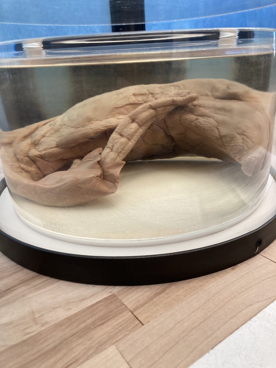 autisticauzy's tweet image. Fetus #AllLivesMatter