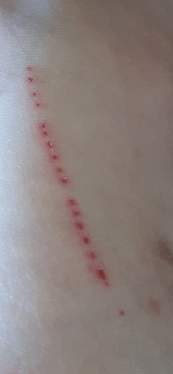 0RmtM7IkpO17's tweet image. #MKultra #ElectronicHarassment