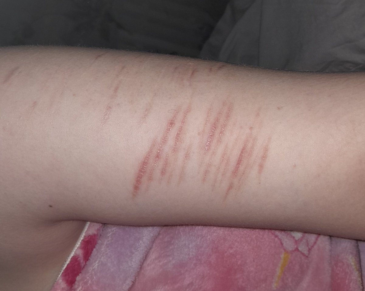 I'm so sorry I dont want to keep myself alive anymore